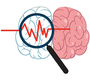 Neurovascular Disorders